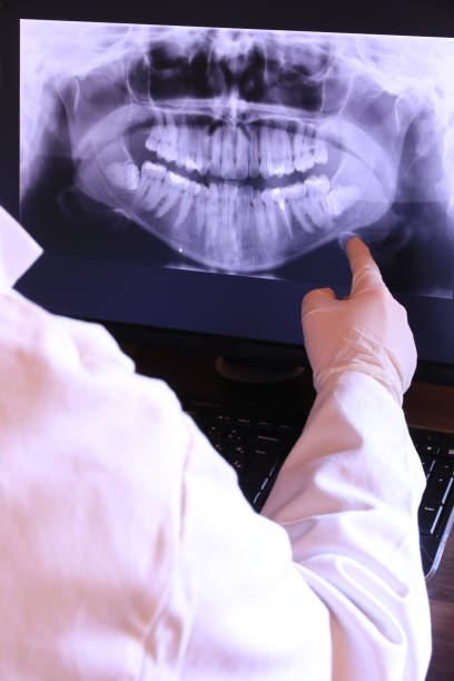 Best Emergency Root Canal Therapy in Chapel Hill, TN